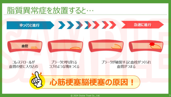 SAMPLE_02